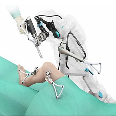 Robotic-Assisted Joint Replacement: A Game Changer