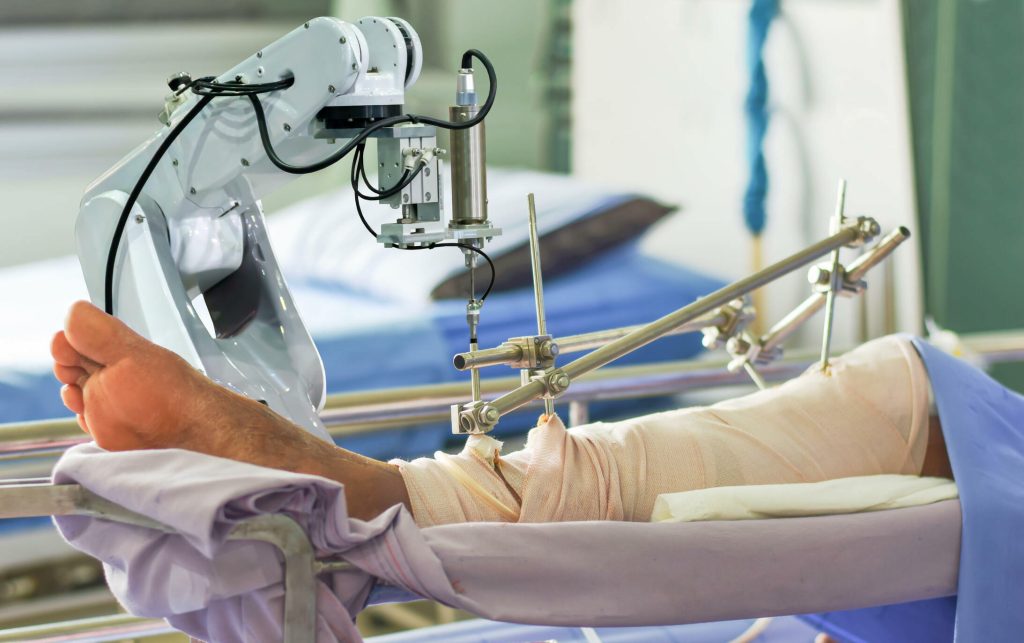Choosing between manual and robotic knee replacement