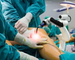 Manual vs Robotic Knee Replacement