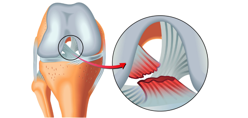 shoulder diseases & conditions